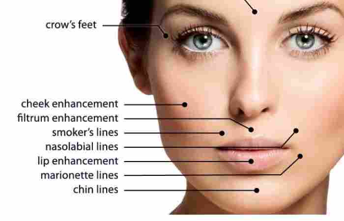 All about Fillers