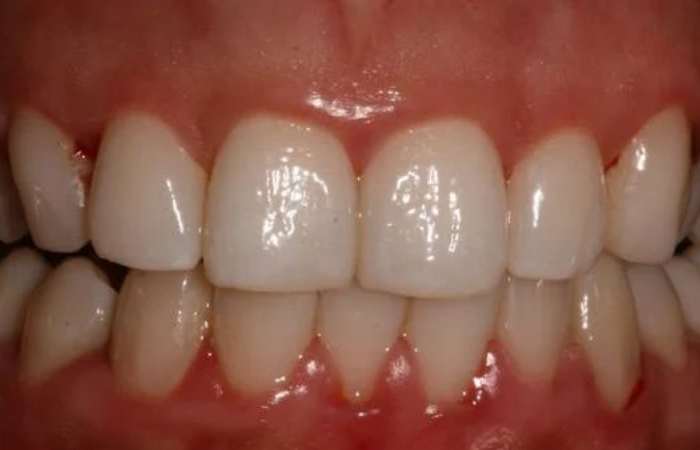 Oral Health